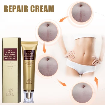 

Hot Scar Removal Cream Acne Removal Treatment Stretch Mark Scar Ointment 30g t6