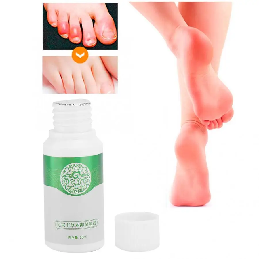 Корректор пальцев ног 35 мл травяной антигрибковый дезодорант против зуда антибактериальный дезодорант Уход за ногами спрей для ног жидкость для вросших ногтей