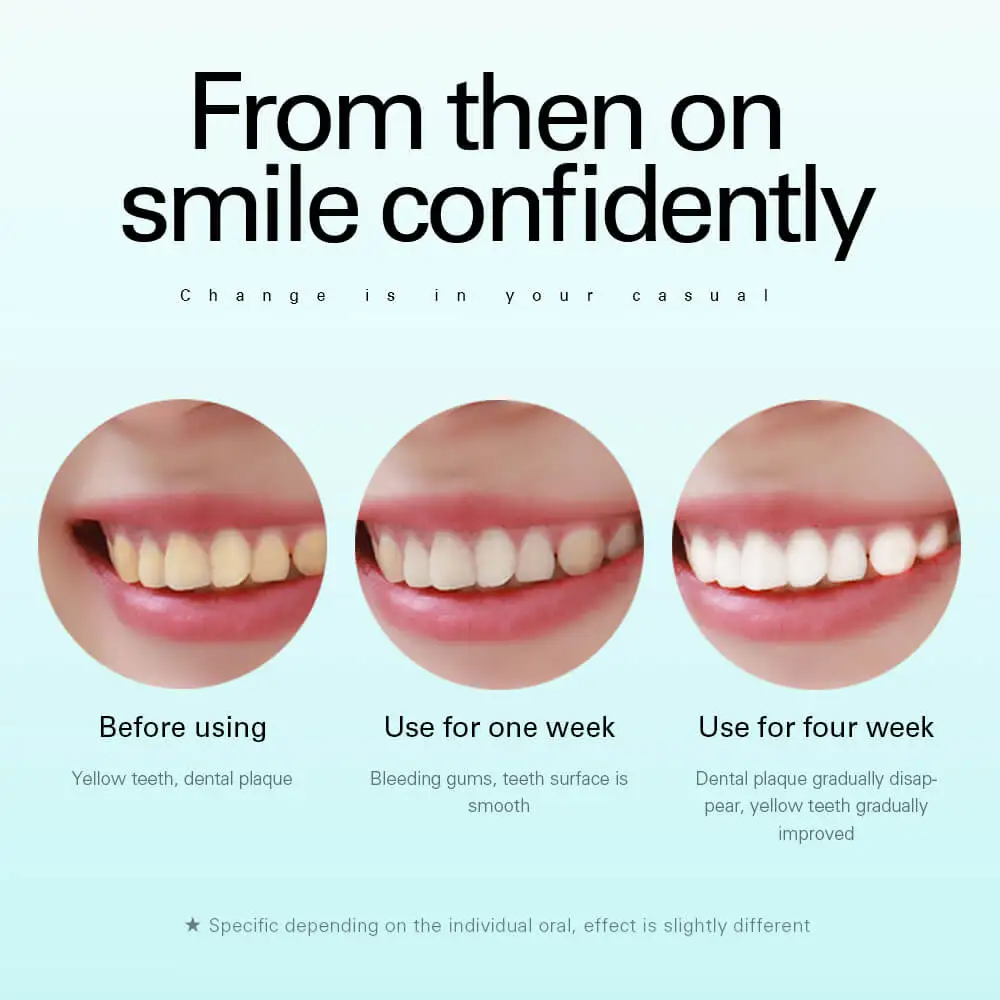 AZDENT AZ-9Pro Ultrasonic Electric Toothbrush 5 Modes USB Rechargeable Teeth Brush Deep Cleaning Teeth Whitening Brush Adult Kid AZDENT AZ-9Pro Ultrasonic Electric Toothbrush 5 Modes USB Rechargeable Teeth Brush Deep Cleaning Teeth Whitening Brush Adult Kid