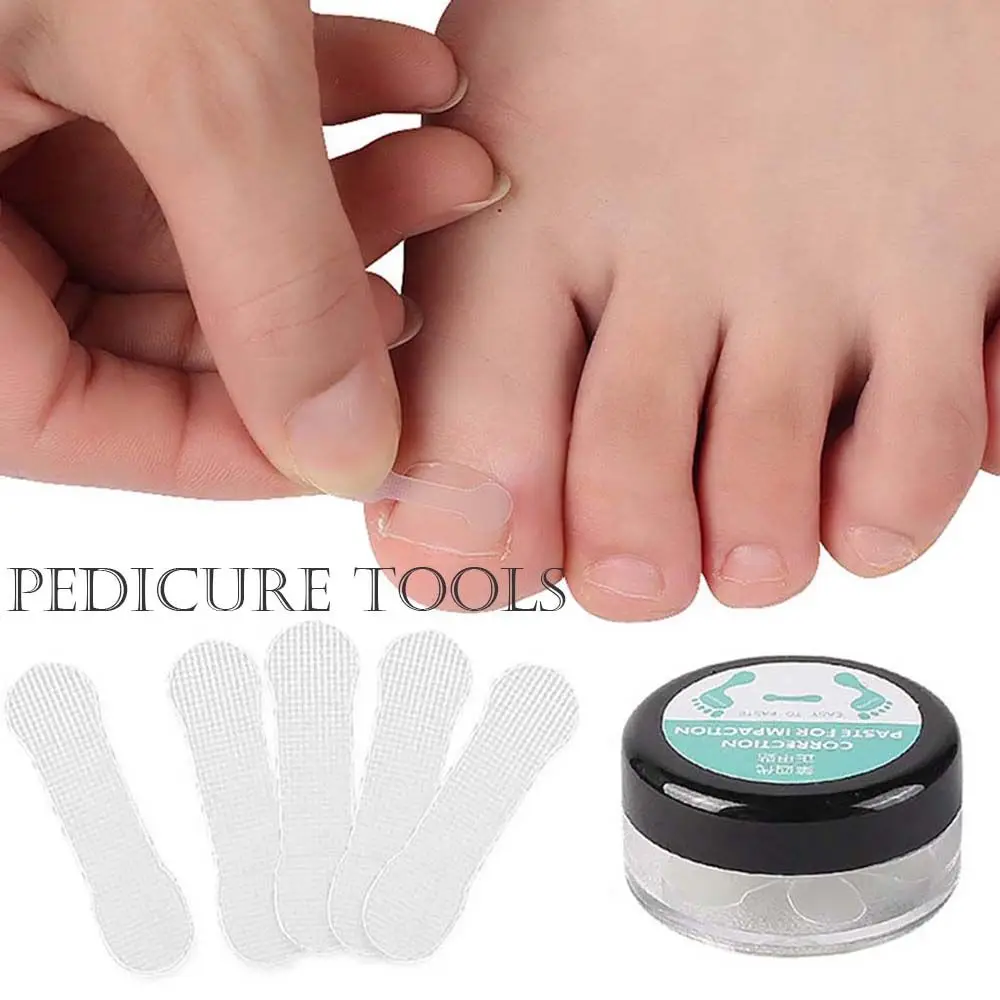 

Care Patch Paronychia Pedicure Tools Ingrown Toenails Stickers Toenail Ortho Sticker Nail Correction Tablets Correction Sticker