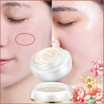 

New Lady Skin Cream Freckles Sunburn Plaques of Pregnancy Face Magic Remove Cream Permanent Whitening Brighten Removal Frec Z1N0