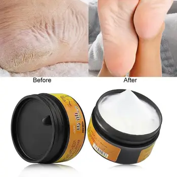 

1 Pc Horse Oil Feet Cream Foot Feet Mask Blisters Anti-chapping Peeling Cream Hand Feet Heel Winter Care Cream TSLM2