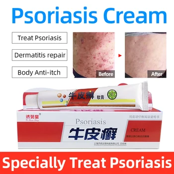 

Natural Herbal Psoriasis Antibacterial Ointment Dermatitis Itching Repair Cream Body Eczema Psoriasis Allergy Skin Treatment