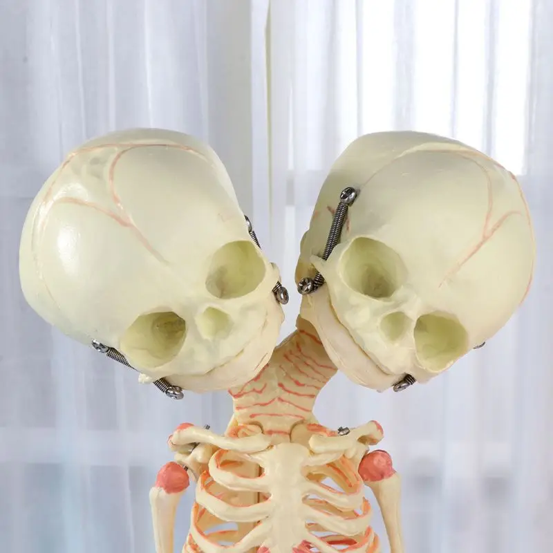  37cm Human Double Head Baby Skull Skeleton Anatomy Brain Display Study Teaching Anatomical Model - 4000040622886
