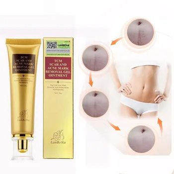 

30ml Extract Against Black Dots Professional Cream Scar Removal Facial Blackhead Skin Care Treatment Bleaching Cream