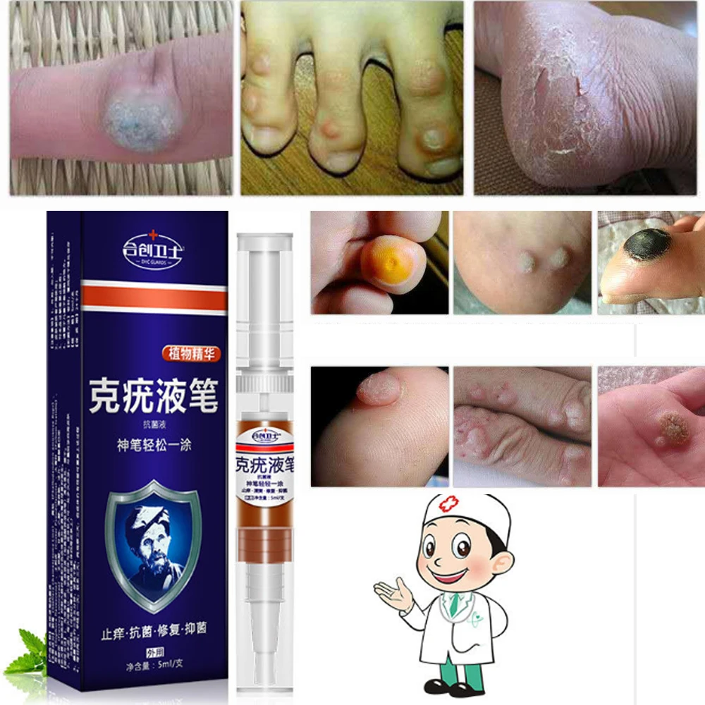 

5ml Body Warts Treatment Cream Skin Tag Remover Foot Corn Removal Plantar Genital Warts Ointment Foot Care Cream D060