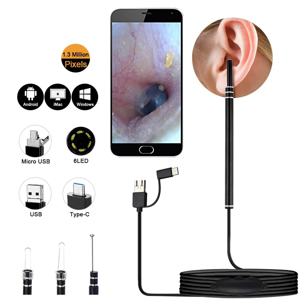 In-Ear-Cleaner-Otoscopio-Medico-Ear-Wax-Removal-Tool-USB-Type-C-Plug-HD-Visual-For