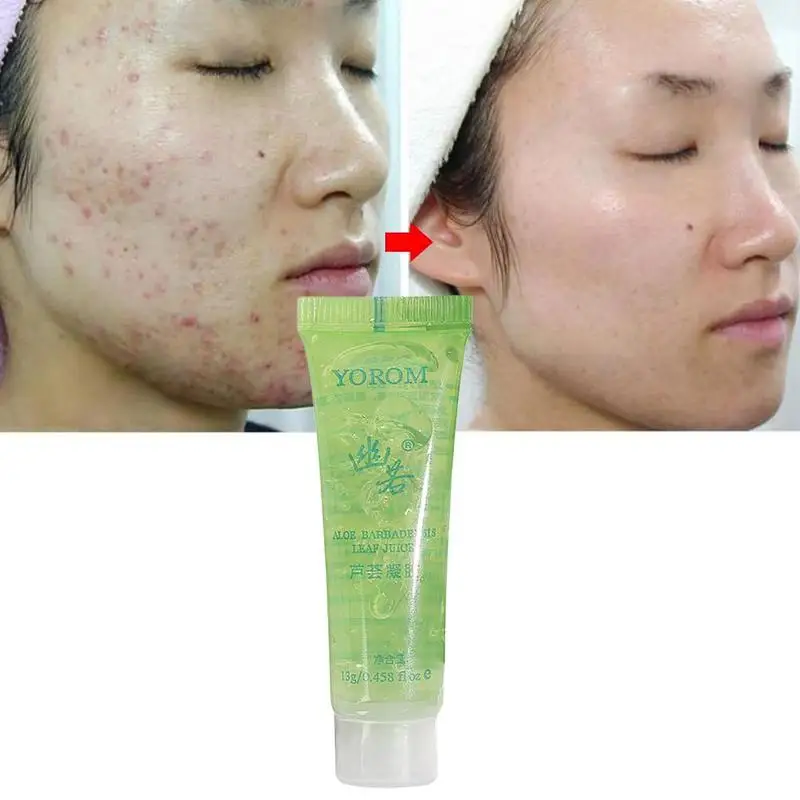 New Aloe Vera Moisturizing Beauty Whitening Sunscreen Moisturizing Whitening  Aloe Vera Gel Moisturizing Acne