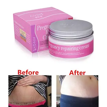 

Stretch Mark Repair Cream Lightening Pigment Brighten Skin Color Stretch Marks Remover