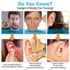 New 5MP Wifi Ear Wax Cleaner Otoscope UV Sterilizer 3.9mm Wireless Visual Nasal Endoscope Camera for ISO Android Device 2