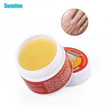 1/2 pces sumifun creme antibacteriano eczema psoríase creme anti coceira alívio eczema pele erupção urticária tratamento