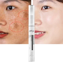 

Whitening Freckle Cream Remove Melasma Acne Spot Pigmentation Dark Spots Moisturizing Nourish Brighten Anti-Aging Face Skin Care