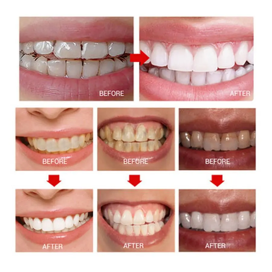 Teeth Whitening Pen Remove Smoke Coffee Stain Dental Tools Oral Hygiene Teeth Cleaning Toothbrush Powder Dental 3