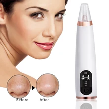 Средство для удаления черных точек, пылесос для очистки пор, электрический инструмент для глубокого очищения лица в носу, инструмент для ухода за кожей, Очищение лица, 3 режима удаления черных точек