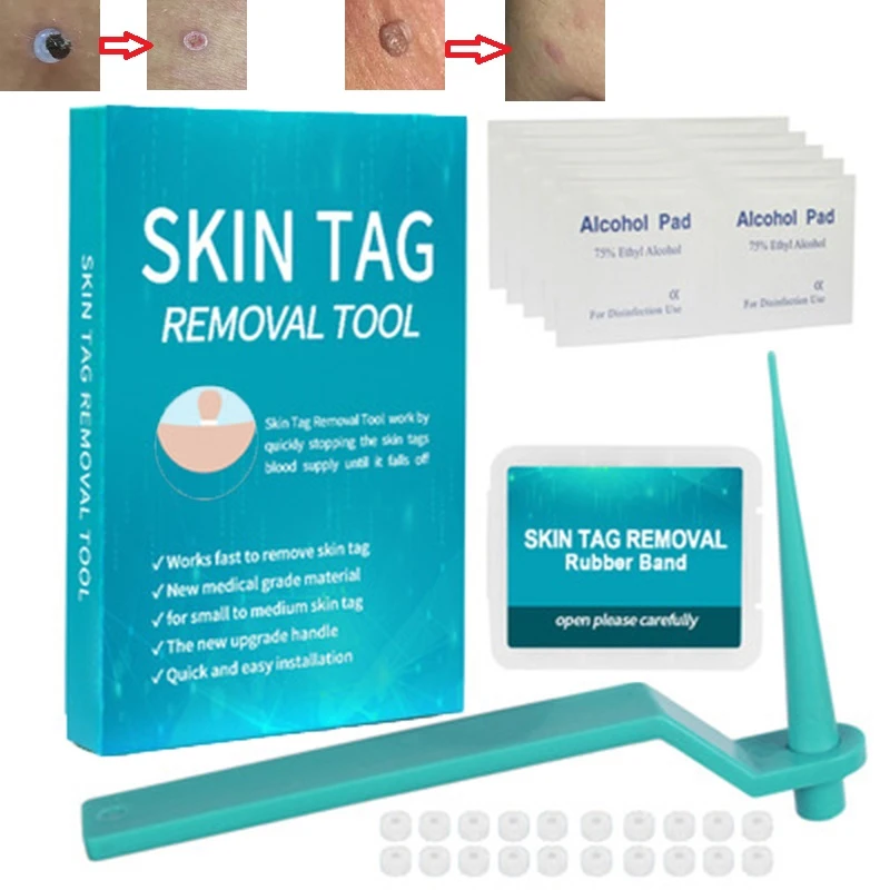 5box Skin Tag Removal Rubber Bands 48mm Non Toxic Face Care Mole Wart Tool 2021新入荷