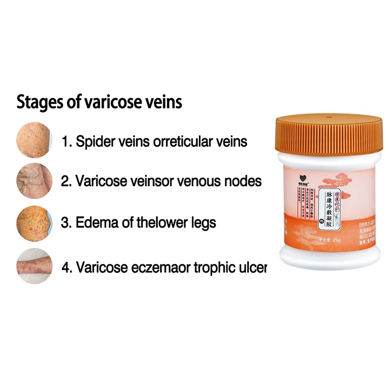 Varicose Vein Ointment Dredge Blood Vessels Varicose Spider Veins Vasculitis Leg Foot