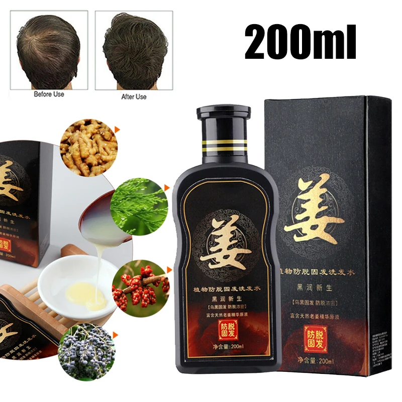 200ml Natural Ginger Shampoo Oil-Control Anti Dandruff Itching Anti-Loss Scalp Treatment Grow Thick Hair Growth Products 200ml Natural Ginger Shampoo Oil-Control Anti Dandruff Itching Anti-Loss Scalp Treatment Grow Thick Hair Growth Products