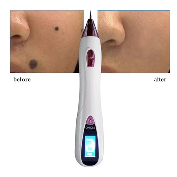 

Laser Plasma Point Mole Pen Dark Spot Freckle Removal Machine Wart Tattoo Removal Beauty Care Skin Care Tool With LCD Display