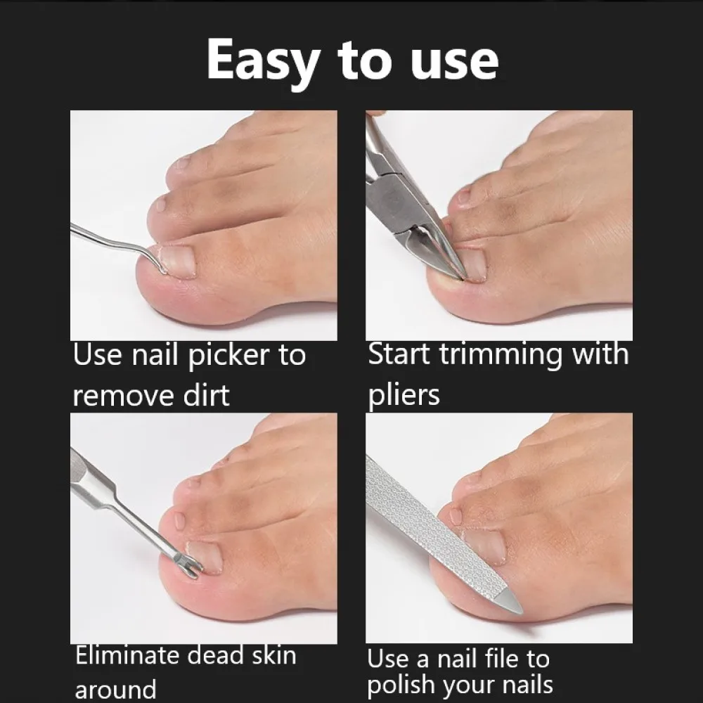Toe Nail Clippers Nail Correction Thick Nails Ingrown Toenails Nippers Cutters Dead Skin Dirt Remover Pedicure Care Tool Pro 4