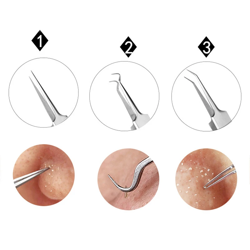 1PC Stainless Steel  Blemish Extractor Tool For Remove Comedones Blackhead Acne Pimple Tools 2020