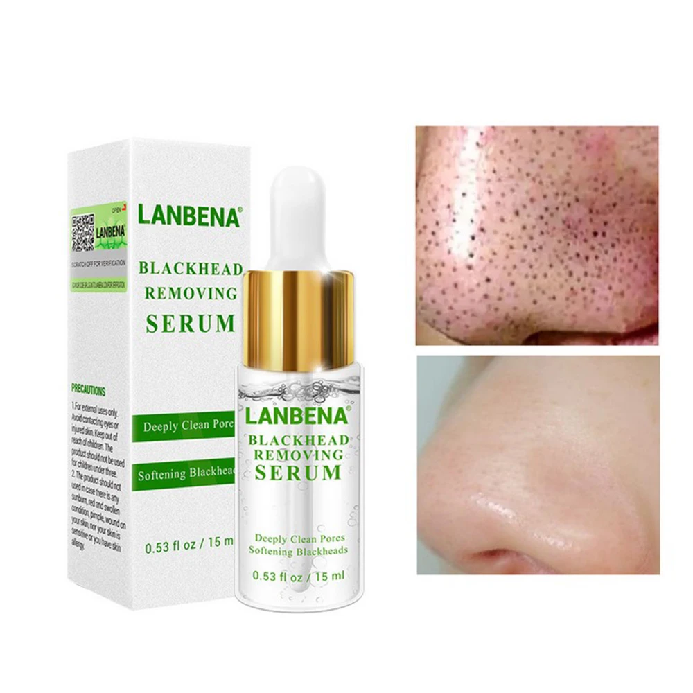 

LANBENA 15ML Nose Deep Blackhead Softener Blackhead Derived Liquid Nose Black Head Remover Acne Treatment Skin Care TSLM1