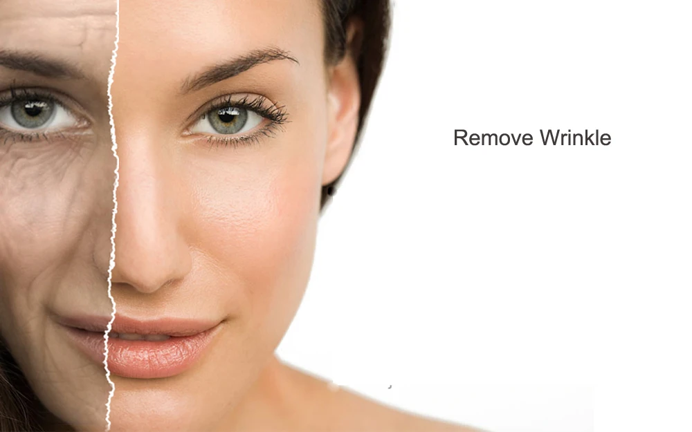 Remove Wrinkles