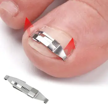 

Ingrown Toenail Corrector Stainless Steel Ingrown Toe Nail Fixer Pedicure Recover Embed Toenail Correction Lifter Tool Kit 1pc