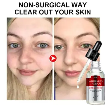 

30ml Whitening Essence Brighten Skin Colour Brightening Anti-Aging Essence Remover Freckle Spots Serum Fades Fine Lines TSLM2