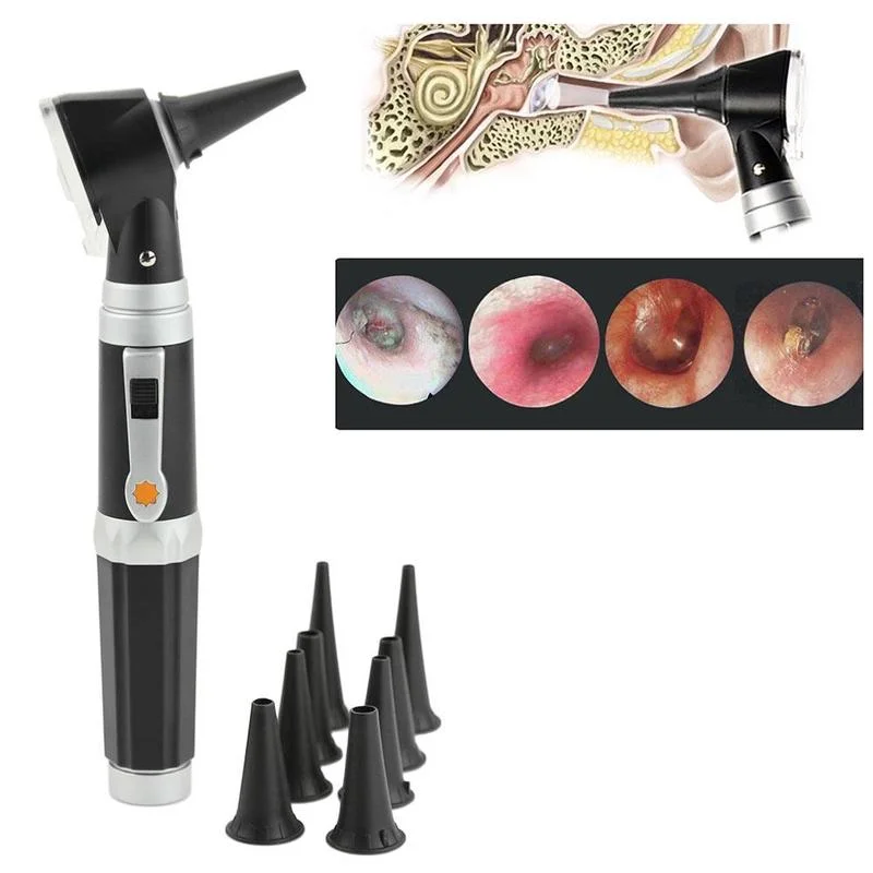 ENT Professional Otoscopio Diagnostic Kit Medical Ear Care Endoscope LED Portable Otoscope