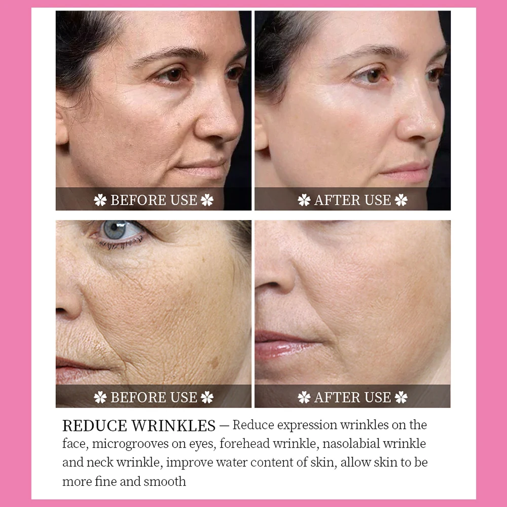 VIBRANT GLAMOUR Argireline Anti Aging Facial Mask Anti Wrinkle Fade Fine Lines Whitening Moisturizing Firming Repair 2