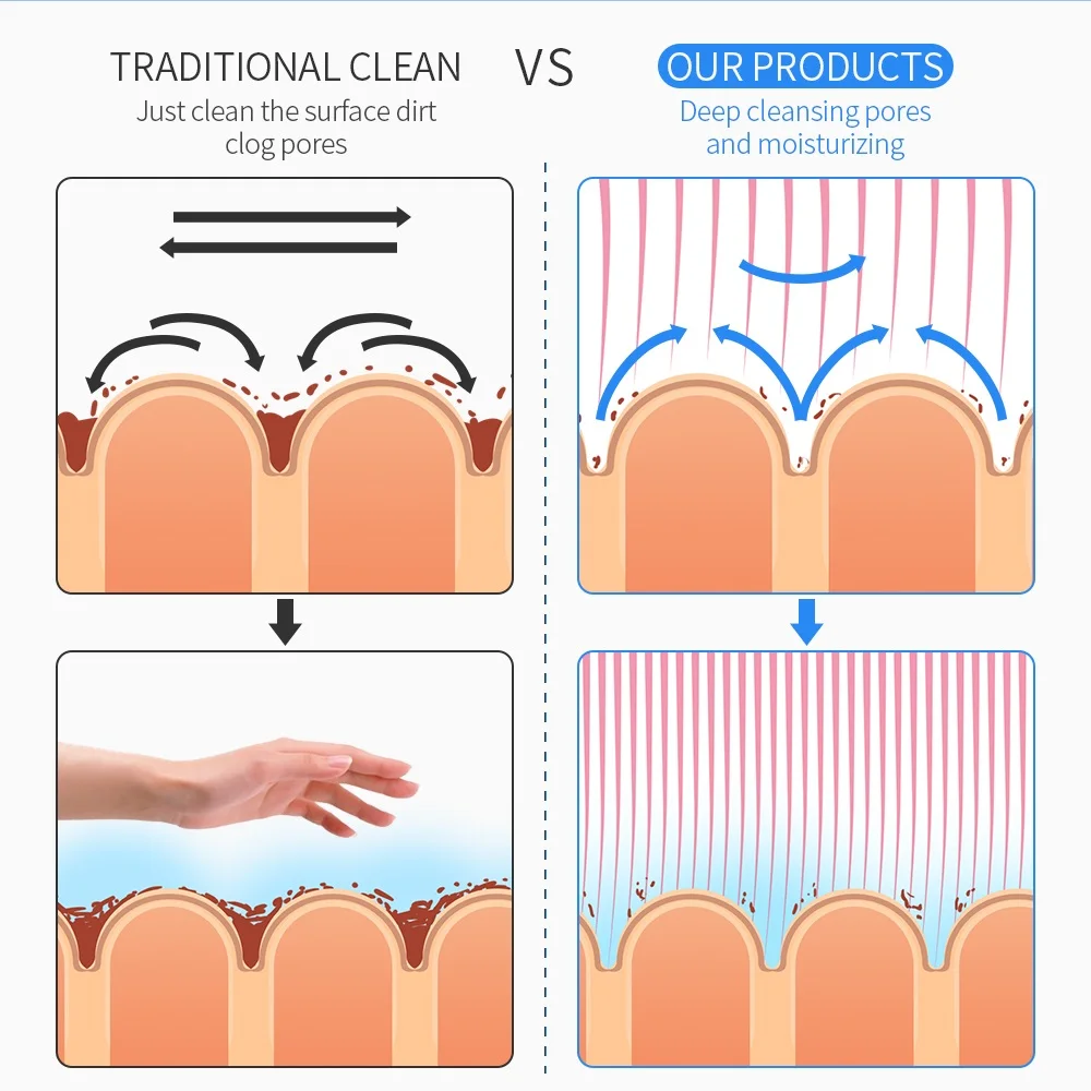Multifunction 6 In 1 Small Bubbles Ultrasonic RF Hydra Deep Facial Ance Pore Cleaner Facial Massage 1 Multifunction 6 In 1 Small Bubbles Ultrasonic RF Hydra Deep Facial Ance Pore Cleaner Facial Massage 5