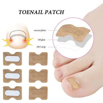 

10Pcs/Lot Ingrown Toenail Corrector Stickers Paronychia Treatment Recover Corrector Pedicure Tools Fingernail Toe Nail Care Tool
