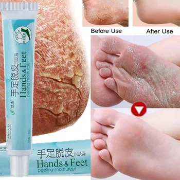 

Exfoliating Refreshing Cosmetics 20g Anti Dry Cracked Heel Repair Skin Care Cream Natural Hand And Foot Moisturizing Nourishing
