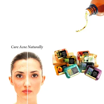 

Calendula Essential Oil Antiallergic Handmade Care Facial Soap Powerful Acne Remover Treatment And Remove Whelk Shrink Pore Face