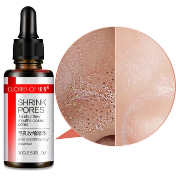 

Face Skin Serum Shrink Pores Essence Blackhead Remover Acne Treatment Oil-control Whitening Serum Moisturize lighten Skin Care