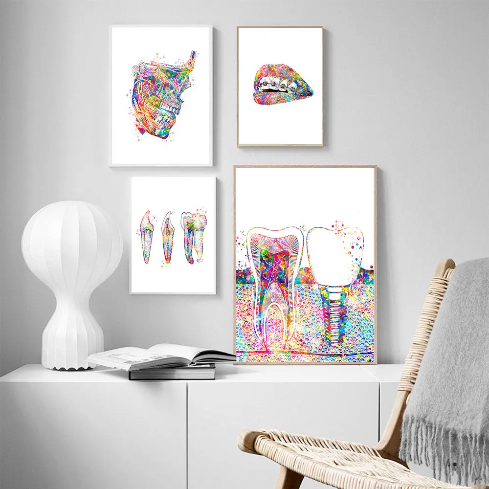 Tooth-Implant-Canvas-Wall-Painting-Dental-Art-Poster-Dentist-Anatomy-Prints-Medical-Wall-Art-Pictures-Hospital (1)