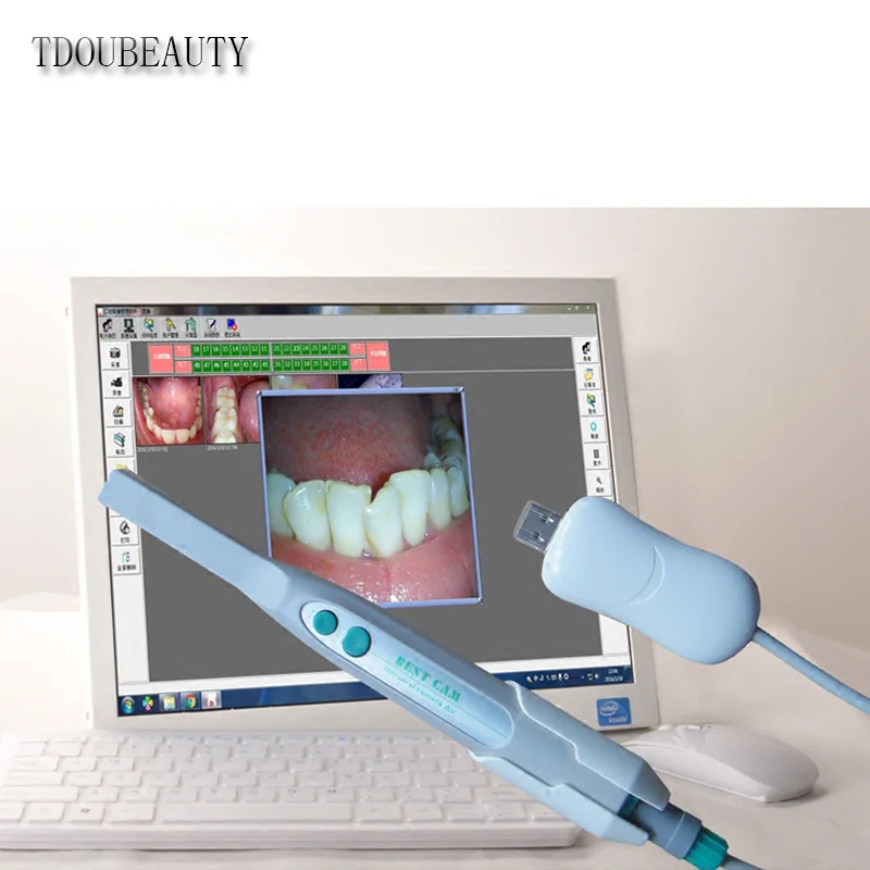 Sistema de Imagem Tdoubeauty Dental Intra Câmera Digital Oral Usb Mega Pixels Frete Grátis 4 m