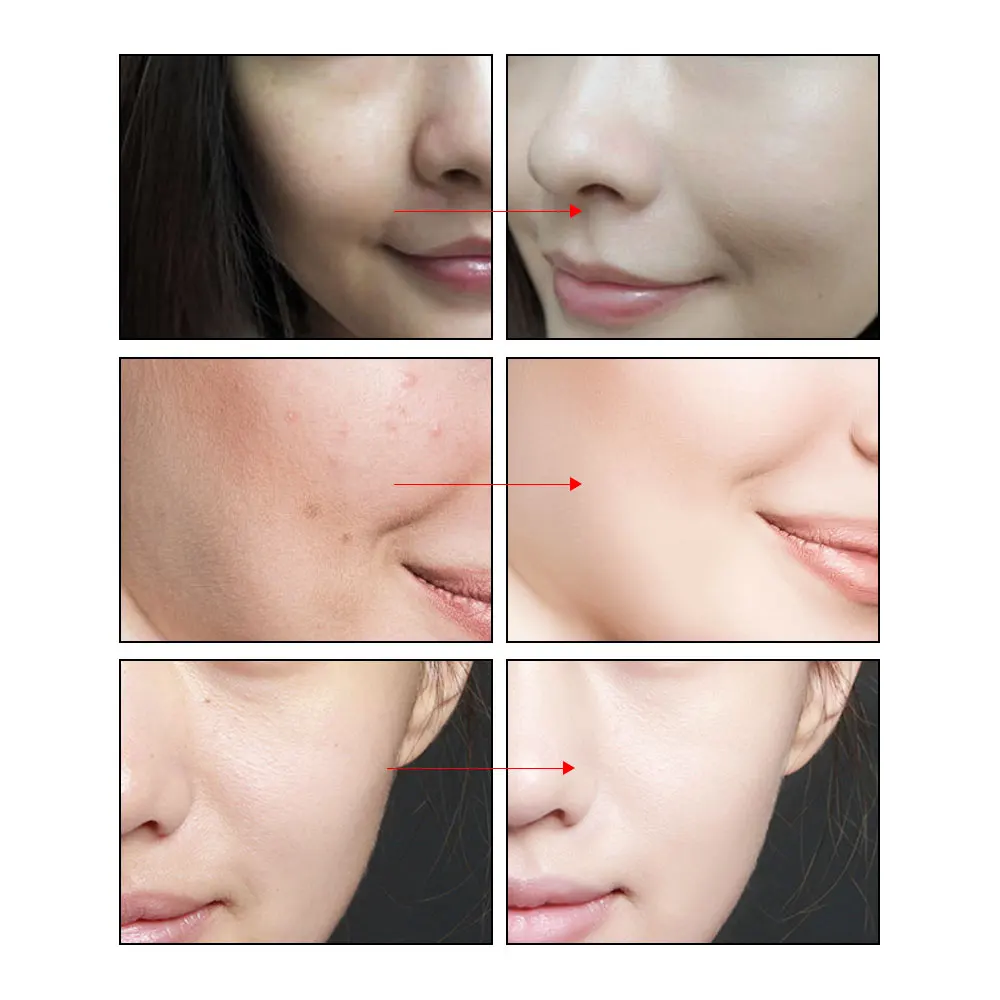 Эссенция никотинамида ARTISCARE сыворотка для отбеливания и осветления создает