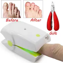 Dispositivo de tratamiento láser frío indoloro para uñas, eliminación de hongos en las uñas, cuidado de los pies, sin efectos secundarios de uñas dispositivo de limpieza, seguridad