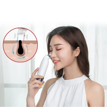 

Beauty Blackhead Remover Face Deep Pore Acne Cleaner Nose Cleansing Device Remove Pimple Skin Tag Nose Cleansing Instrument*
