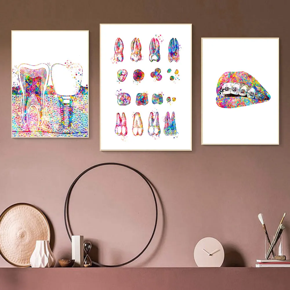 Tooth-Implant-Canvas-Wall-Painting-Dental-Art-Poster-Dentist-Anatomy-Prints-Medical-Wall-Art-Pictures-Hospital (2)