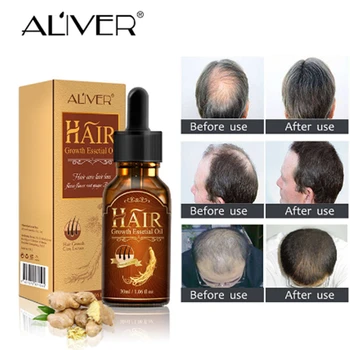 

ALIVER Hair Growth Serum Hair Care Hair Growth Essential Oil Authentic Herbs Hair Loss Health Care Essence Beauty Dense