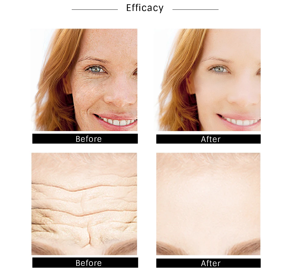 胶原蛋白精华液_07