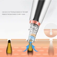 Пористая Кожа Уход Инструмент usb зарядка вакуумное всасывание ABS угрей очиститель Регулируемый режим удаления акне Электрический Уход за лицом портативный