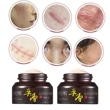 50 г натуральное растение ремонт эссенция крем Удаление Шрама от акне пятен лечение увлажняющий от веснушек лосьон Красота Косметика