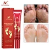 Foot Care Cream Foot spa Pedicure Herbal Detox Anti Fungal Infection Onychomycosis Fungus Treatment   For legs ► Photo 3/6