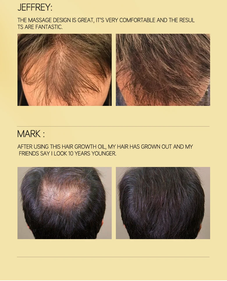 Hairinque Vitamin B7 Hair Growth Oil Prevent Hair Loss Serum Scalp