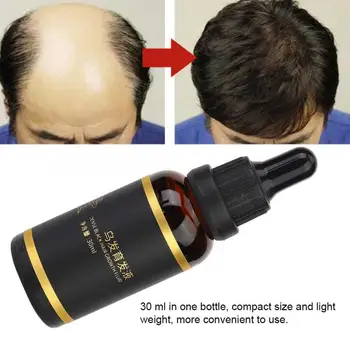 

Beard Growth Oil Unisex Fast Hair Growth Liquid Anti Hair Loss Treatment Nourishing 30ml Hair Care Product