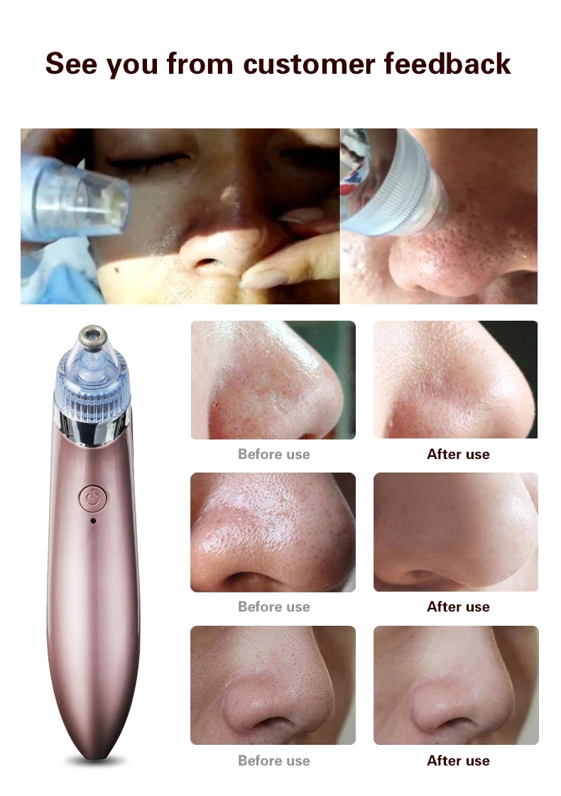 英文吸黑头美容仪_10