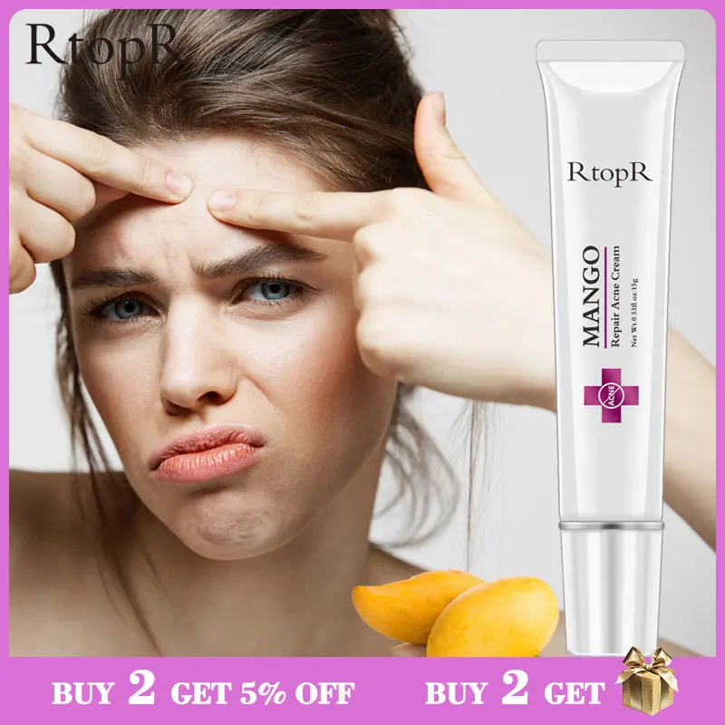 

Mango Repair Acne Cream Anti Acne Spots Acne Treatment Scar Blackhead Cream Shrink Pores Whitening Moisturizing Face Skin Care